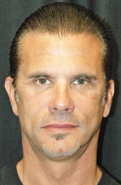 Lorenzo Lamas After Facelift